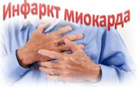 Симптомы инфаркта миокарда