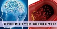 Очищение сосудов головного мозга