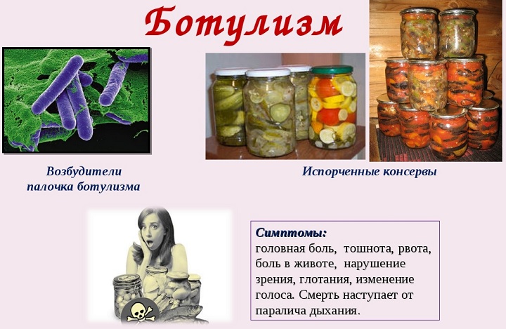 Симптомы ботулизма