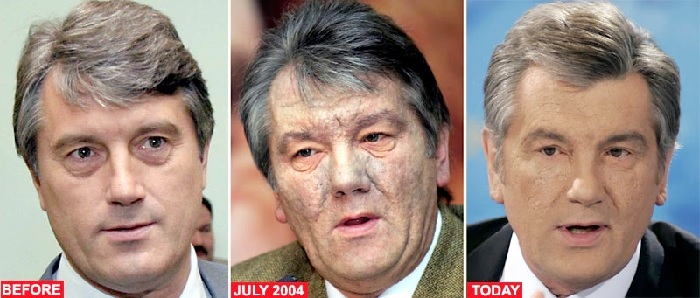 Отравление Ющенко