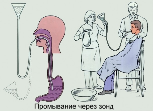 Лечение отравления сосисками